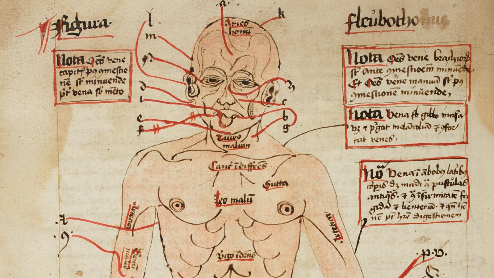 رسم تخطيطي من القرن السادس عشر ، يُظهر فتح الأوردة لإراقة الدماء- صورة من مكتبة جامعة كامبريدج