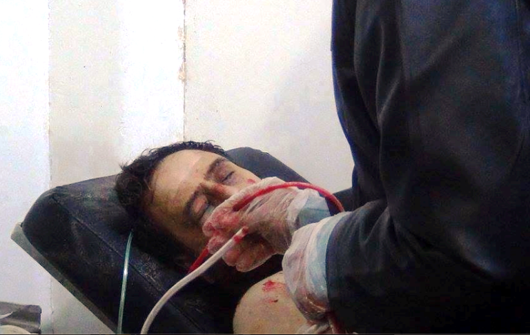 أحد المصابين بغاز السارين في المعضمية بريف دمشق