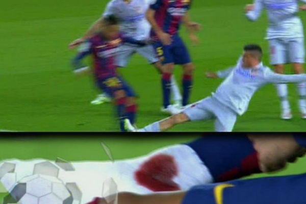 تدخل مدافع أتلتيكو مدريد خيمينيز على نيمار وظهور دمائه على جوارب قدمه