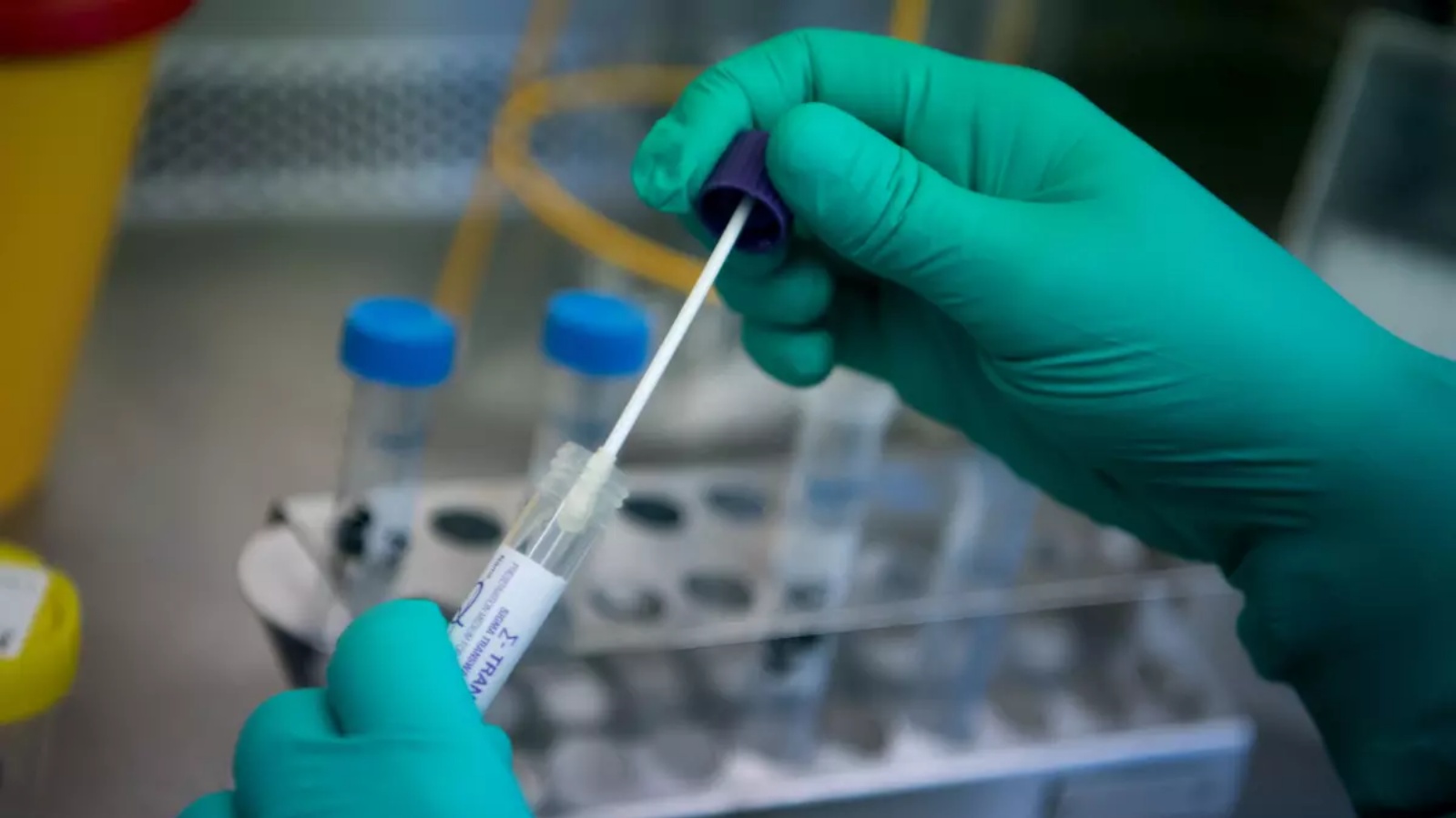 عامل مختبر في السلطات الصحية بولاية بادن فورتمبيرغ في ألمانيا يفحص عينة من مريض يشتبه في إصابته بفيروس كورونا 